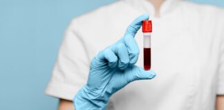 Що виключити перед здачею крові: порада