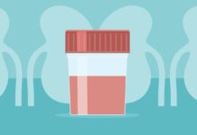 Управление обострениями IgA-нефропатии: практическое руководство