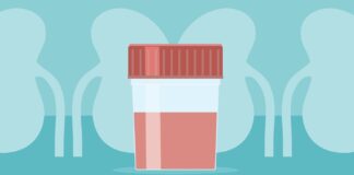 Управление обострениями IgA-нефропатии: практическое руководство