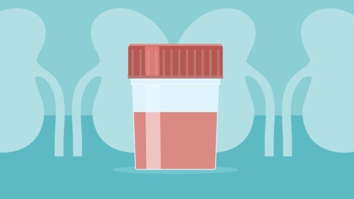 130e1183-2b32-4a3f-847f-59df8ff1d0cb