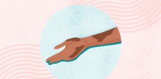 Екзема: Вивчення сверблячої правди про це поширене шкірне захворювання