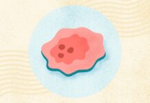 Понимание Рака: Риски, Диагностика и Лечение