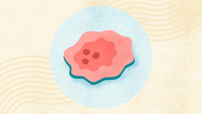 c8d917d7-4372-4399-a2d1-8b5d1ed6ac6b