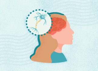 Рассеянный склероз: понимание симптомов, причин и современных методов лечения