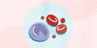 Understanding Lymphoma: Types, Symptoms, and Treatment Pathways