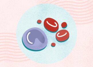 Понимание лимфомы: типы, симптомы и методы лечения