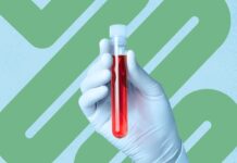 Il tuo sangue. Un colon. Una scelta.