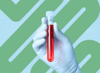 Il tuo sangue. Un colon. Una scelta.