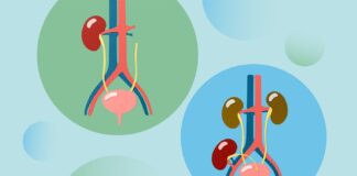 IgA Nefropathie: De Transplantatie Gok